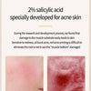 Acne Removing Salicylate Products